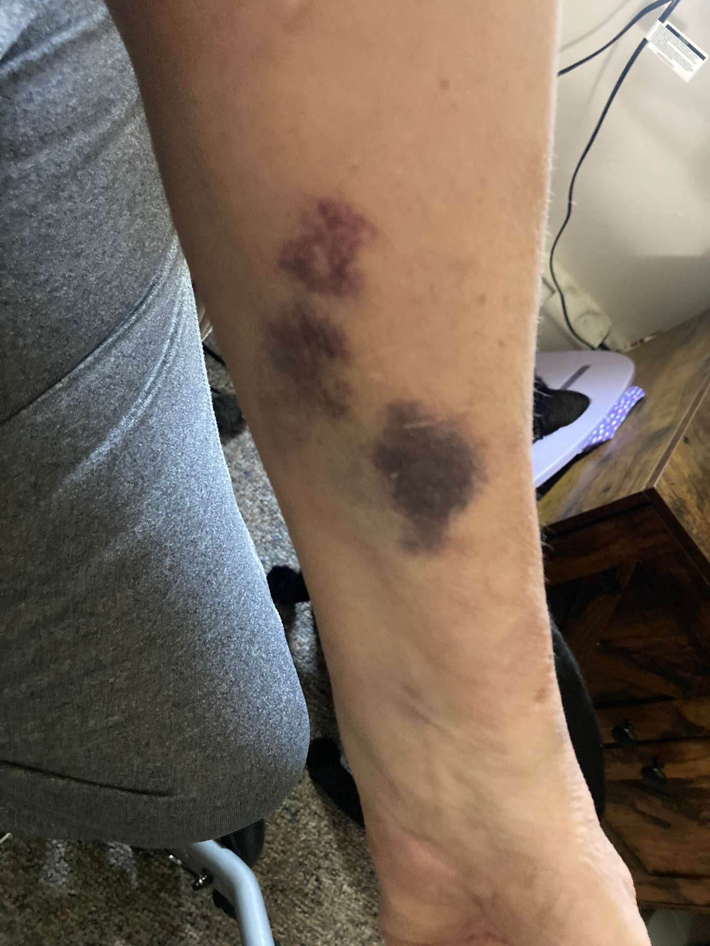 Doesn’t hurt